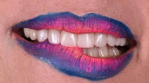 veneers_kronen1_web